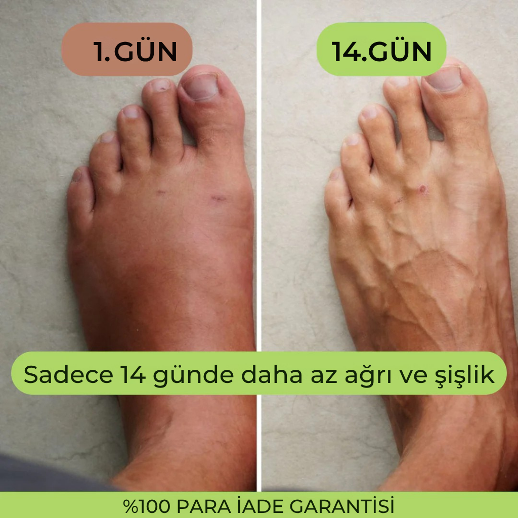 SinusRay™-3'ü 1 Arada Ayak Masaj ve Terapi Cihazı