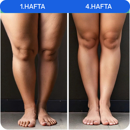 Diz ve Omuz Masaj -Terapi Cihazı